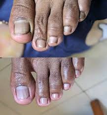 EFERO SOLUTION UNIQUE DE RÉPARATION DES ONGLES