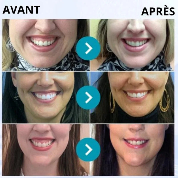 Poudre Dentaire: Blanchir vos dents en moins de 07 jours