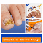 Charger l&#39;image dans la galerie, Adieu Aux Mycoses Des Ongle en 7 Jours Avec Notre Sérum Solution De Traitement Des Ongles
