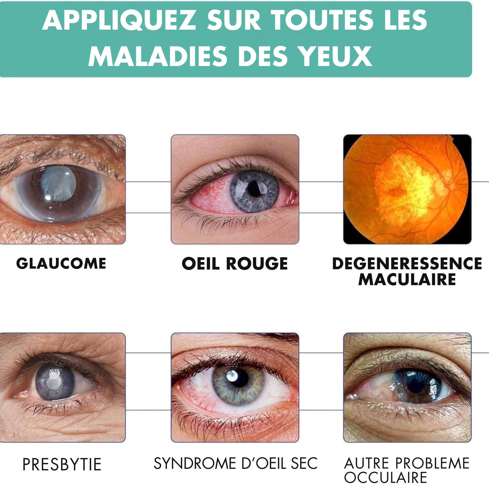 ROULEAU VISION FLOUE - GUERIR TOUTES MALADIES DES YEUX
