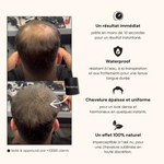 Charger l&#39;image dans la galerie, Poudre Capillaire Flexienna™ – Camouflez instantanément les zones sans cheveux
