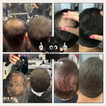 Charger l&#39;image dans la galerie, Poudre Capillaire Flexienna™ – Camouflez instantanément les zones sans cheveux
